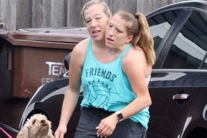 Abby and Brittany Hensel Sad News: A Closer Look at Their Journey and Legacy
