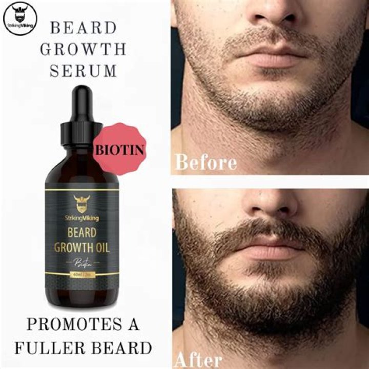 Does Beard Oil Help in Beard Growth? Unlock the Secrets of a Lush Beard
