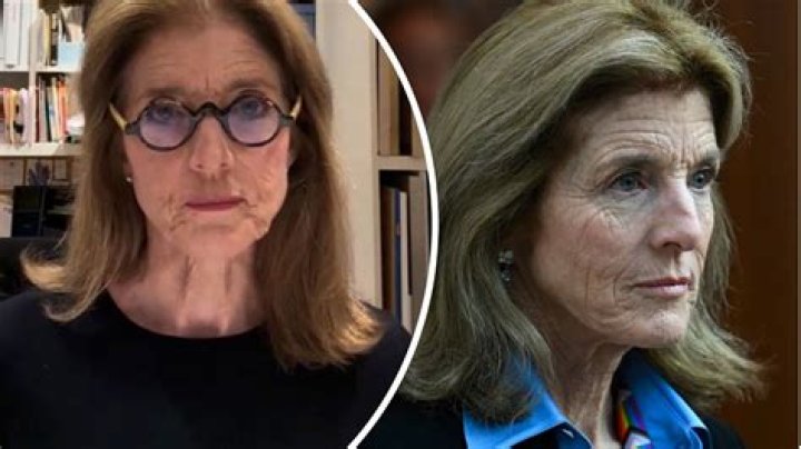 Exploring the Truth Behind Caroline Kennedy's Skin Condition