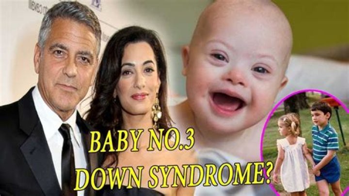 George Clooney's Son: Understanding His Journey with Down Syndrome