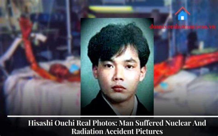 Hisashi Ouchi Photos Real: A Deep Dive into the Life and Legacy of a Tragic Incident