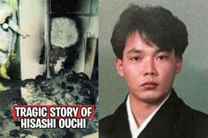 Hisashi Ouchi: The Untold Story Behind the Real Photos and Tragic Incident