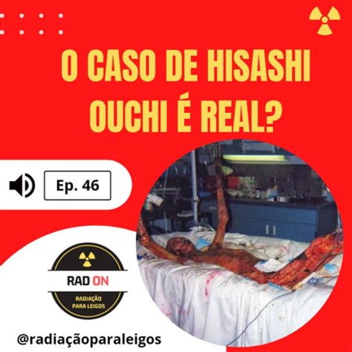Hisashi Real Photos Day 80: A Comprehensive Look at the Iconic Collection