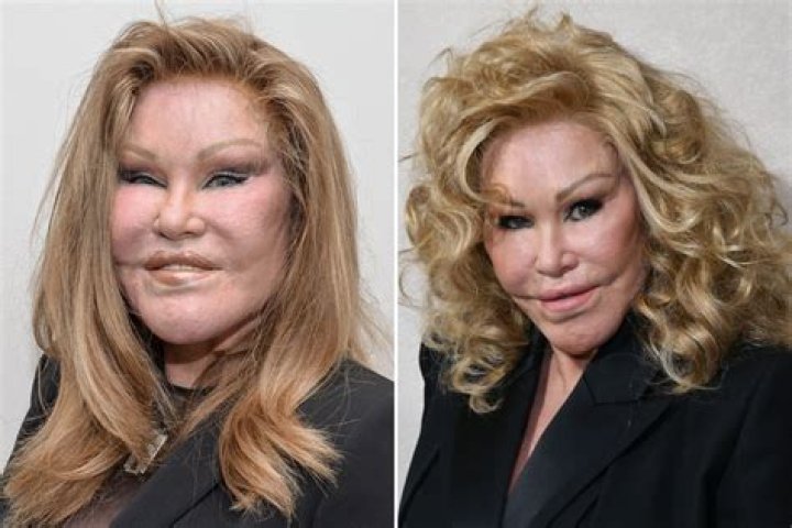Jocelyn Wildenstein Before Plastic Surgery: A Journey Through Transformation and Beauty Standards