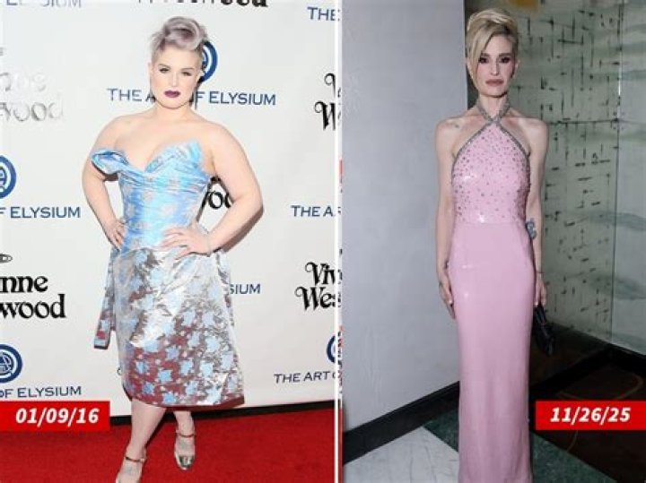 Kelly Osbourne Before and After: A Journey of Transformation and Resilience