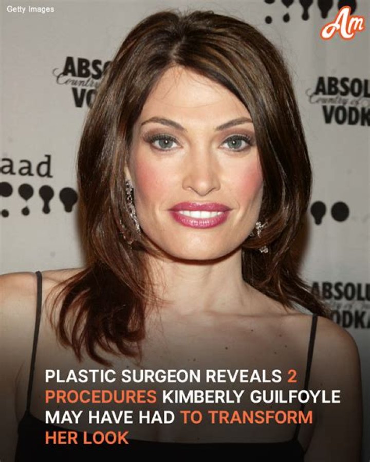 Kimberly Guilfoyle Before and After Plastic Surgery: A Comprehensive Look at Her Transformation