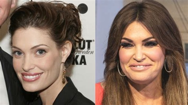 Kimberly Guilfoyle Before Plastic Surgery: A Deep Dive into Her Transformation
