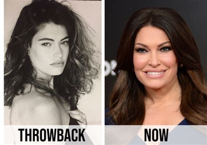 Kimberly Guilfoyle Before Plastic Surgery: A Deep Dive into Transformation and Beauty Standards