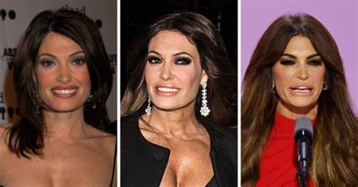 Kimberly Guilfoyle Before Surgery: A Comprehensive Look at Her Transformation