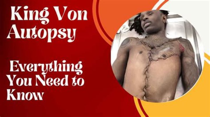 King Von Autopsy Released: An In-Depth Review of the Findings and Their Impact on Fans and the Music Industry