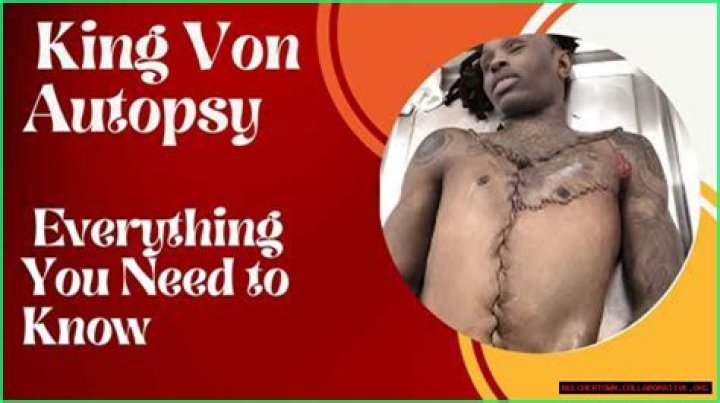 King Von Autopsy Results: Unveiling the Truth Behind the Tragic Loss
