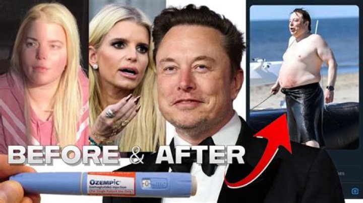 Ozempic Before and After Celebrities: Transformations That Inspire