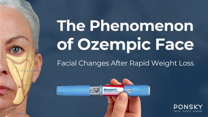 Ozempic Face Celebrities Before and After: The Ultimate Guide