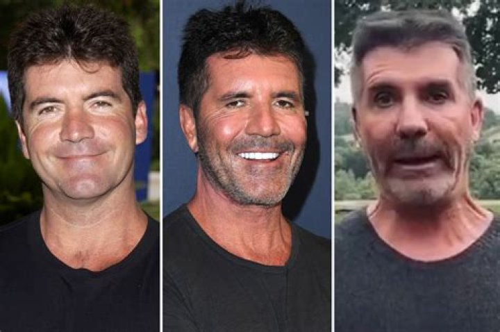 Simon Cowell's Son Illness 2023: Understanding the Challenges and Triumphs