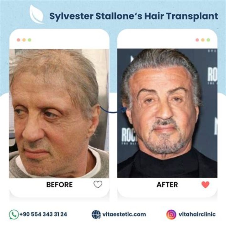 Sylvester Stallone Hair: A Comprehensive Look at His Iconic Hairstyles Through the Years