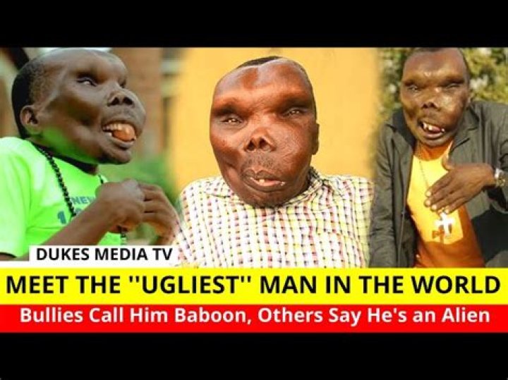 The Most Ugliest Man in the World: Unveiling the Story Beyond Appearances